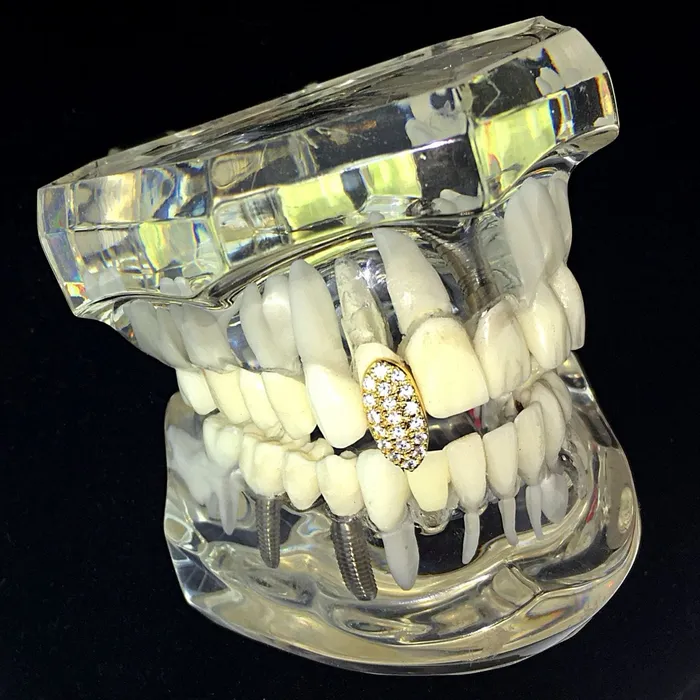 Bling Cartel Admin PreStyled Sets 18k Gold Plated Iced CZ Vampire Fang Single Top Tooth Cap