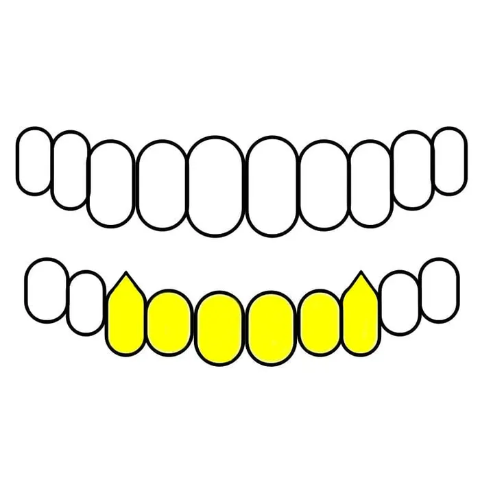 Real 10K Gold FourOpen Vampire Fang Custom Grillz Bling Cartel Admin Rings